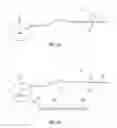 Fig. 02 - Stimulation system and method treating a neurological disorder
