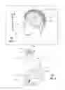 Fig. 02 - Apparatus for managing a neurological disorder