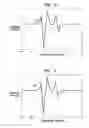 Fig. 04 - Electrode cuffs
