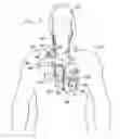 Fig. 07 - Electrode cuffs