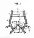 Fig. 02 - Collapsible and re-expandable prosthetic heart valve cuff designs and complementary technological applications