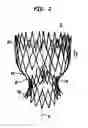 Fig. 03 - Collapsible and re-expandable prosthetic heart valve cuff designs and complementary technological applications