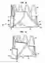 Fig. 11 - Collapsible and re-expandable prosthetic heart valve cuff designs and complementary technological applications
