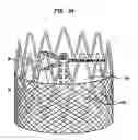 Fig. 18 - Collapsible and re-expandable prosthetic heart valve cuff designs and complementary technological applications