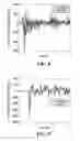 Fig. 09 - Method and apparatus for measuring data for injury analysis