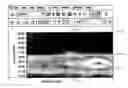 Fig. 01 - Program product to screen for longitudinal-seam anomalies