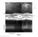 Fig. 09 - Program product to screen for longitudinal-seam anomalies