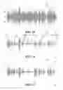 Fig. 11 - MULTI-CHANNEL NOISE SUPPRESSION SYSTEM