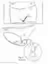 Fig. 02 - WOMAN'S UNDERGARMENT