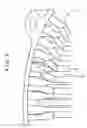 Fig. 10 - Stator manufacturing method