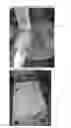 Fig. 10 - Cork outer soled shoes and method for fabrication