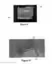Fig. 05 - Device and method for determining the fill level of a flexible medicine reservoir