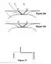 Fig. 09 - Device and method for determining the fill level of a flexible medicine reservoir