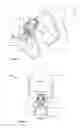 Fig. 04 - INHALER