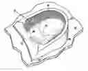 Fig. 01 - Lateral support craniocervical orthosis and method