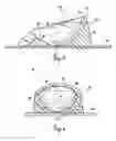Fig. 03 - Lateral support craniocervical orthosis and method