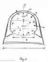 Fig. 05 - Lateral support craniocervical orthosis and method