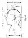 Fig. 09 - Lateral support craniocervical orthosis and method