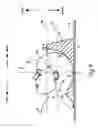 Fig. 11 - Lateral support craniocervical orthosis and method