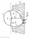Fig. 16 - Lateral support craniocervical orthosis and method