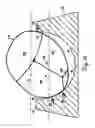 Fig. 17 - Lateral support craniocervical orthosis and method