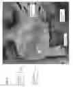 Fig. 11 - NASAL DEVICES HAVING A SAFE FAILURE MODE AND REMOTELY ACTIVATABLE