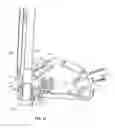 Fig. 20 - Integrated vacuum wand and method of use