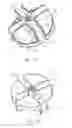 Fig. 03 - Top support structure of tent frame