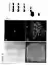 Fig. 11 - Primitive vascular progenitor cells and uses thereof