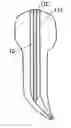 Fig. 01 - Dental implant