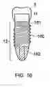 Fig. 17 - Dental implant