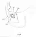 Fig. 07 - Head massager and its helmet