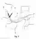 Fig. 06 - Water conserving improved toilet