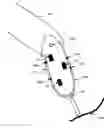 Fig. 01 - Prosthetic socket stabilization apparatus and technique