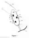 Fig. 02 - Prosthetic socket stabilization apparatus and technique
