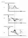 Fig. 38 - Blood pressure measurement device