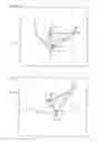 Fig. 02 - Extracapsular surgical procedure and surgical referencing instrument therefor