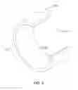 Fig. 06 - Coupling ring