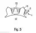Fig. 04 - Coil for an electric machine and method for producing a coil