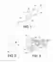 Fig. 02 - Method for Treating Headaches with Intra-Aural Devices
