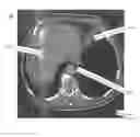 Fig. 01 - Calibration method for ring artifact correction in non-ideal isocentric 3D rotational X-ray scanner systems using a calibration phantom based rotation center finding algorithm