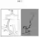 Fig. 03 - DISTAL PART GUIDING CATHETER