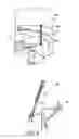 Fig. 05 - Acromioclavicular joint fixation technique