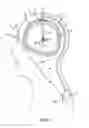 Fig. 02 - Methods and apparatus for using sensors with a deep brain stimulation system
