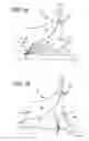 Fig. 04 - TWO PIECE IMPELLER