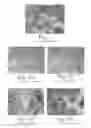 Fig. 02 - Biological fixative and method of using the biological fixative