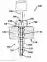 Fig. 01 - Methods and devices for providing access into a body cavity