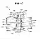 Fig. 07 - Methods and devices for providing access into a body cavity