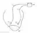Fig. 01 - Method and apparatus for minimizing post-infarct ventricular remodeling