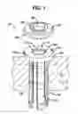 Fig. 02 - Inverted conical expandable retractor
